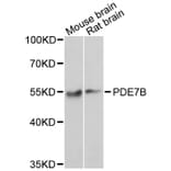 Western Blot - Anti-PDE7B Antibody (A7633) - Antibodies.com