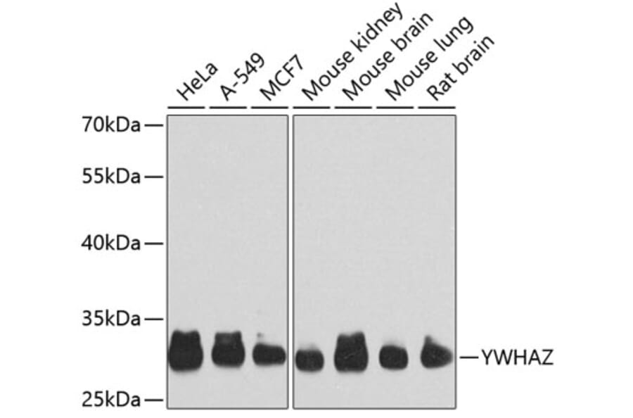 Western Blot - Anti-14-3-3 zeta Antibody (A10177) - Antibodies.com