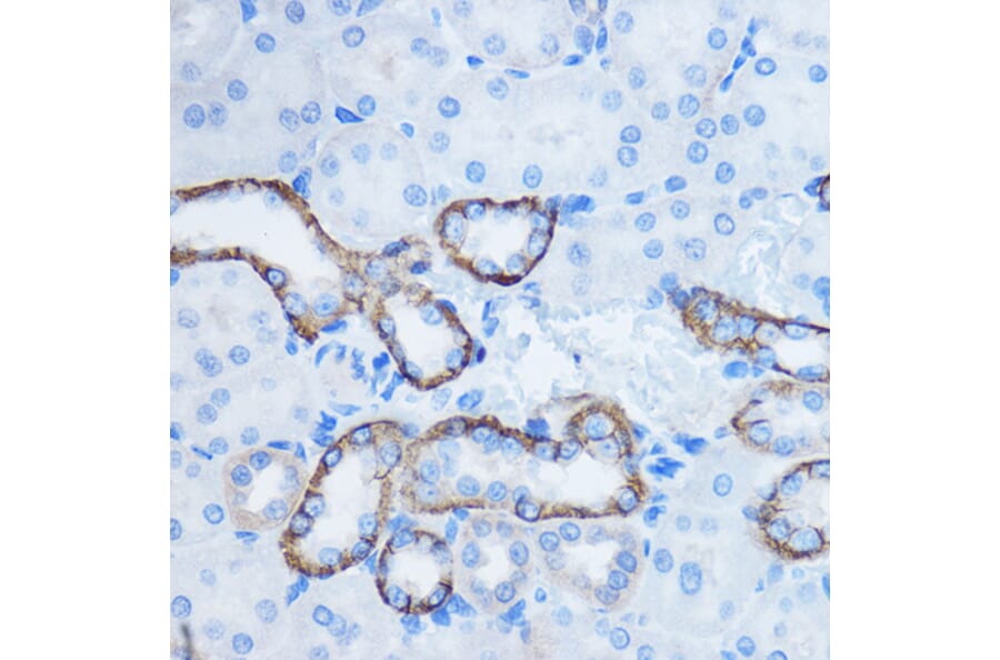 Immunohistochemistry - Anti-14-3-3 zeta Antibody (A10177) - Antibodies.com