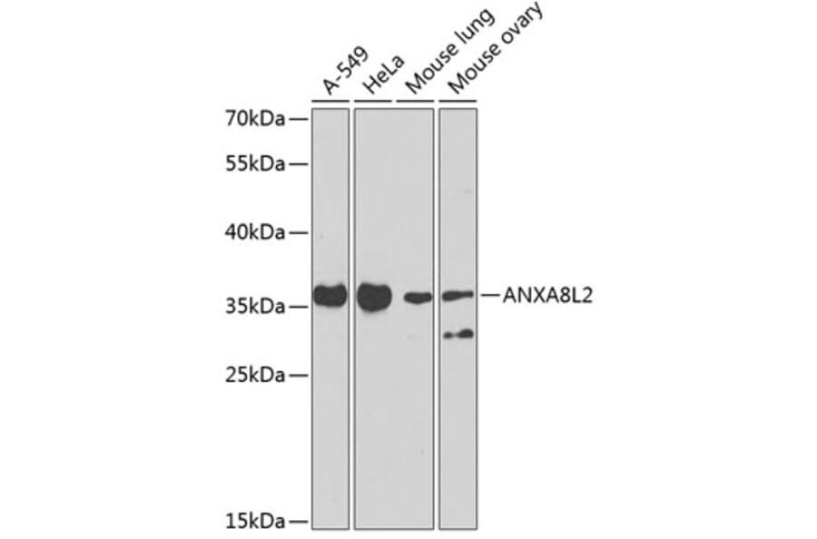 Western Blot - Anti-AnnexinA8 like2 Antibody (A10178) - Antibodies.com