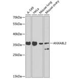 Western Blot - Anti-AnnexinA8 like2 Antibody (A10178) - Antibodies.com