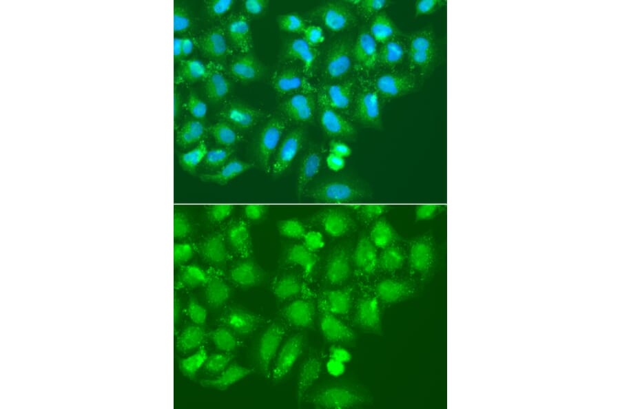 Immunofluorescence - Anti-AMY2B Antibody (A7642) - Antibodies.com
