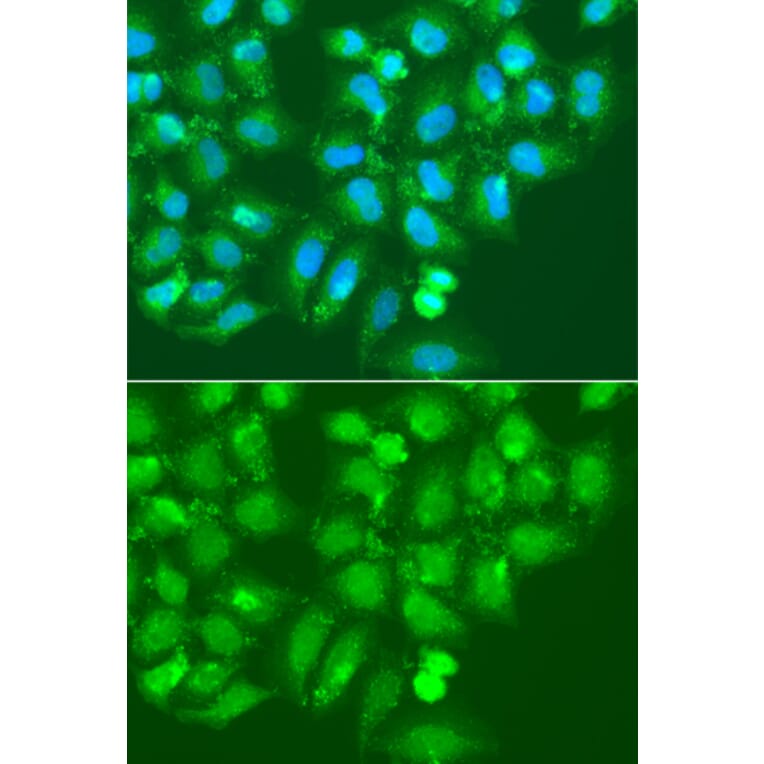 Immunofluorescence - Anti-AMY2B Antibody (A7642) - Antibodies.com