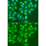 Immunofluorescence - Anti-AMY2B Antibody (A7642) - Antibodies.com