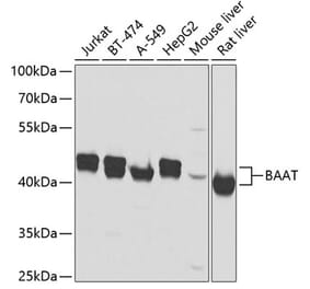 Western Blot - Anti-BAAT Antibody (A10180) - Antibodies.com