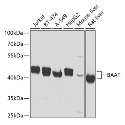 Western Blot - Anti-BAAT Antibody (A10180) - Antibodies.com