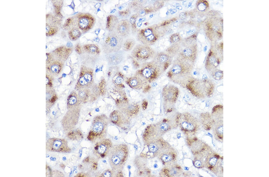 Immunohistochemistry - Anti-BAAT Antibody (A10180) - Antibodies.com