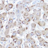 Immunohistochemistry - Anti-BAAT Antibody (A10180) - Antibodies.com