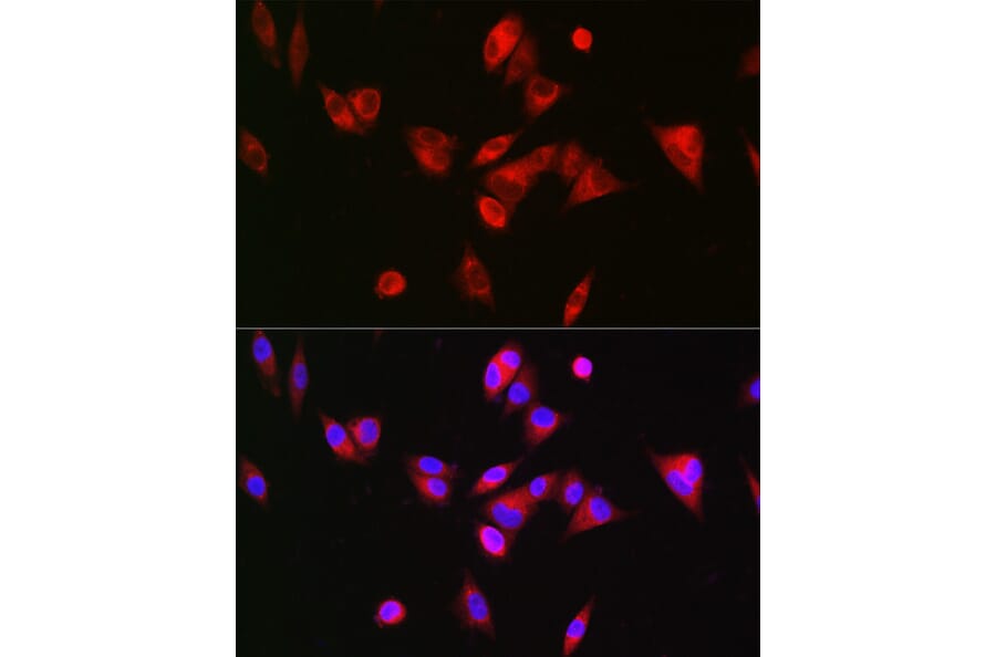 Immunofluorescence - Anti-BAAT Antibody (A10180) - Antibodies.com