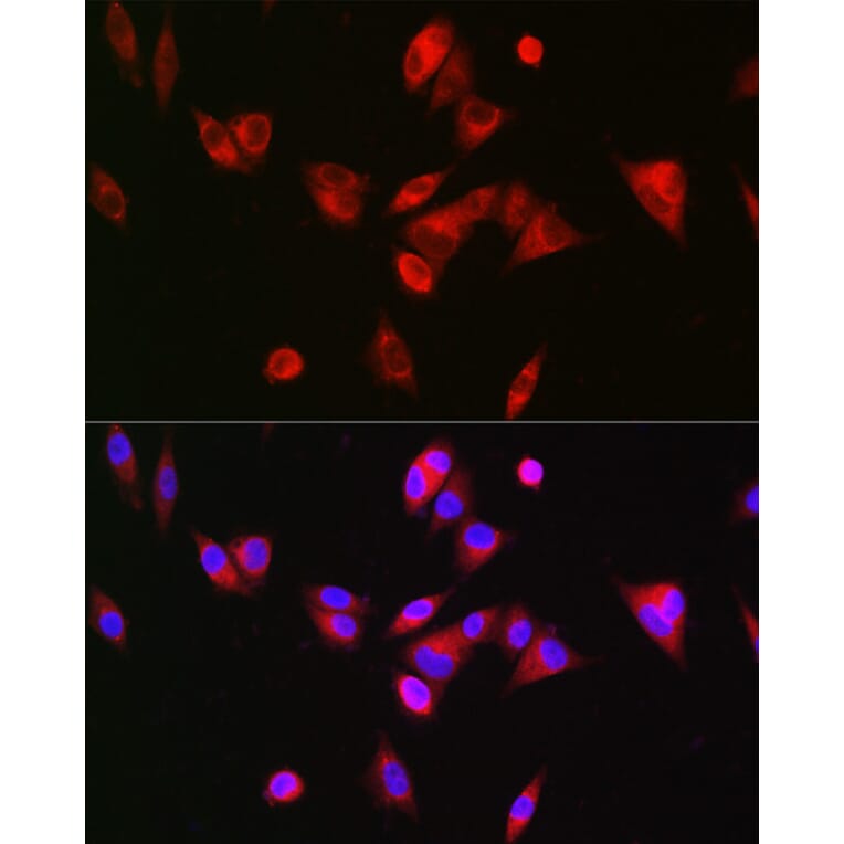 Immunofluorescence - Anti-BAAT Antibody (A10180) - Antibodies.com