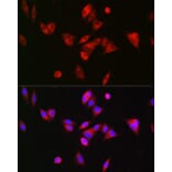 Immunofluorescence - Anti-BAAT Antibody (A10180) - Antibodies.com