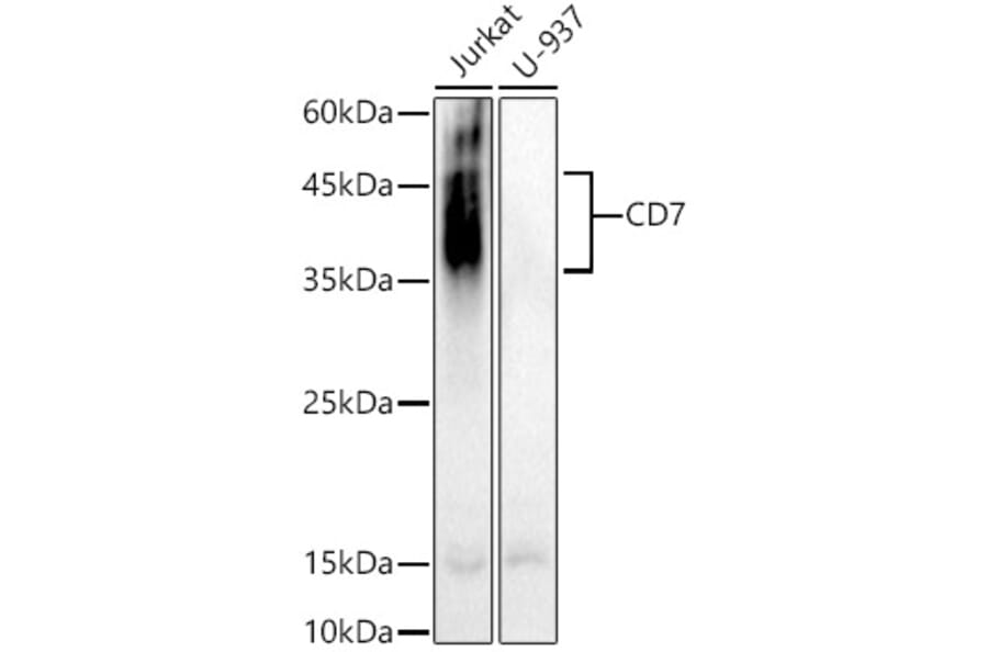 Western Blot - Anti-CD7 Antibody (A10181) - Antibodies.com