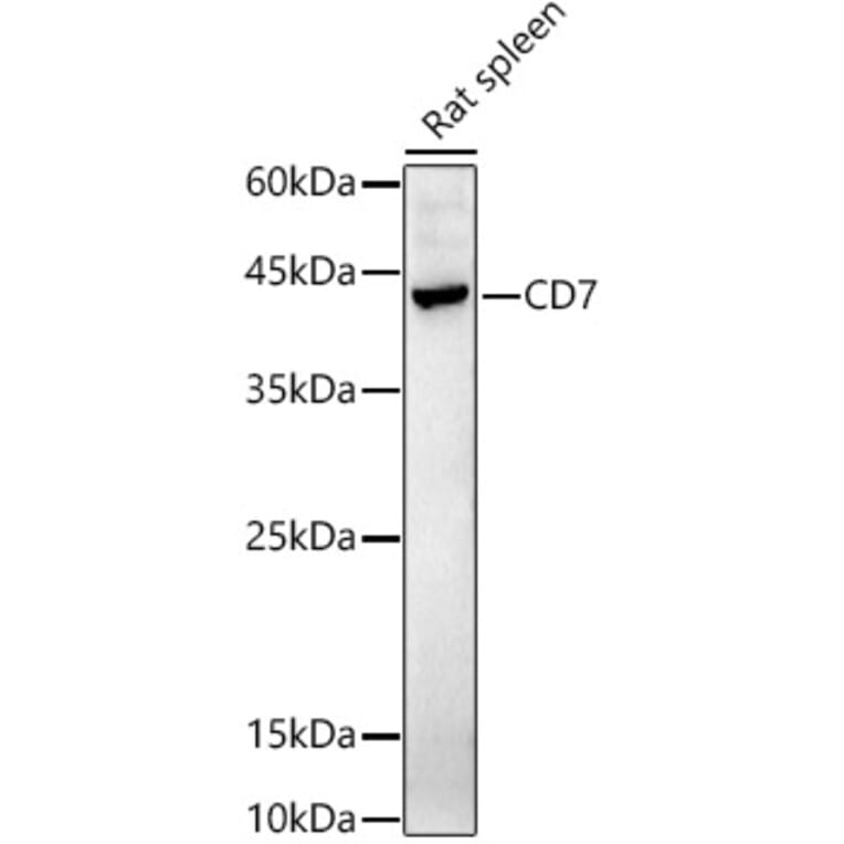 Western Blot - Anti-CD7 Antibody (A10181) - Antibodies.com