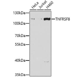 Western Blot - Anti-CD30 Antibody (A10182) - Antibodies.com