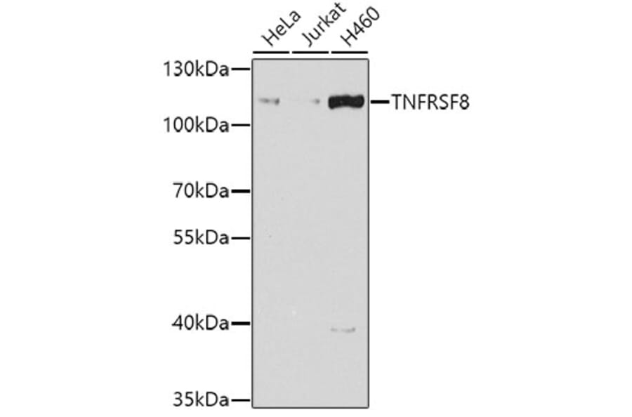 Western Blot - Anti-CD30 Antibody (A10182) - Antibodies.com
