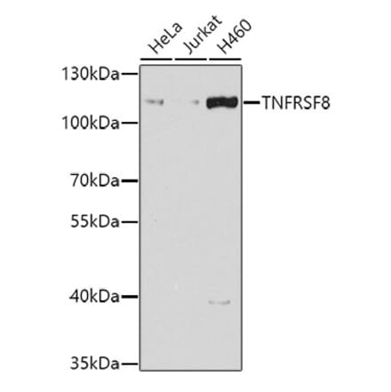 Western Blot - Anti-CD30 Antibody (A10182) - Antibodies.com