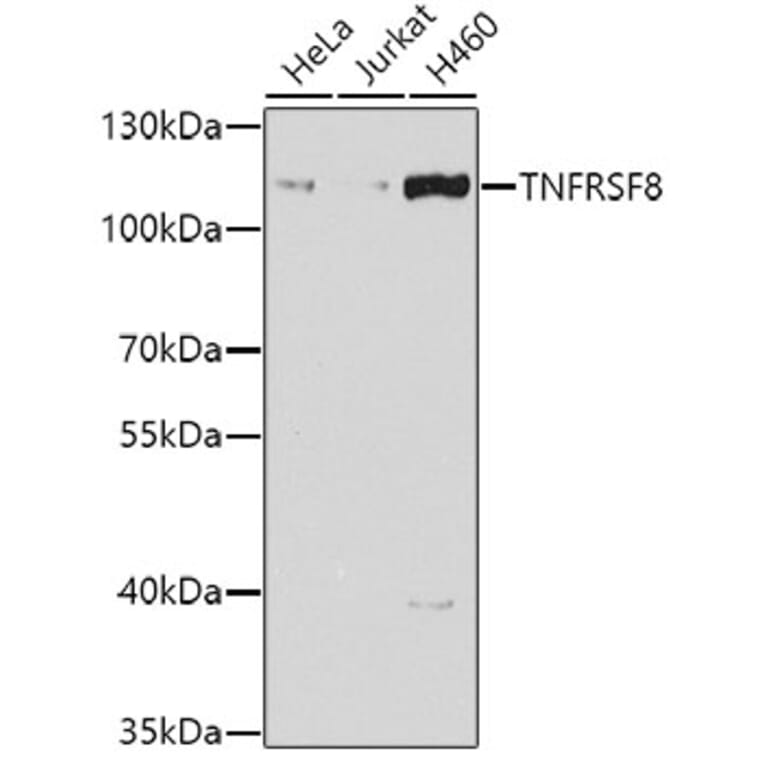 Western Blot - Anti-CD30 Antibody (A10182) - Antibodies.com