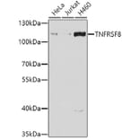 Western Blot - Anti-CD30 Antibody (A10182) - Antibodies.com