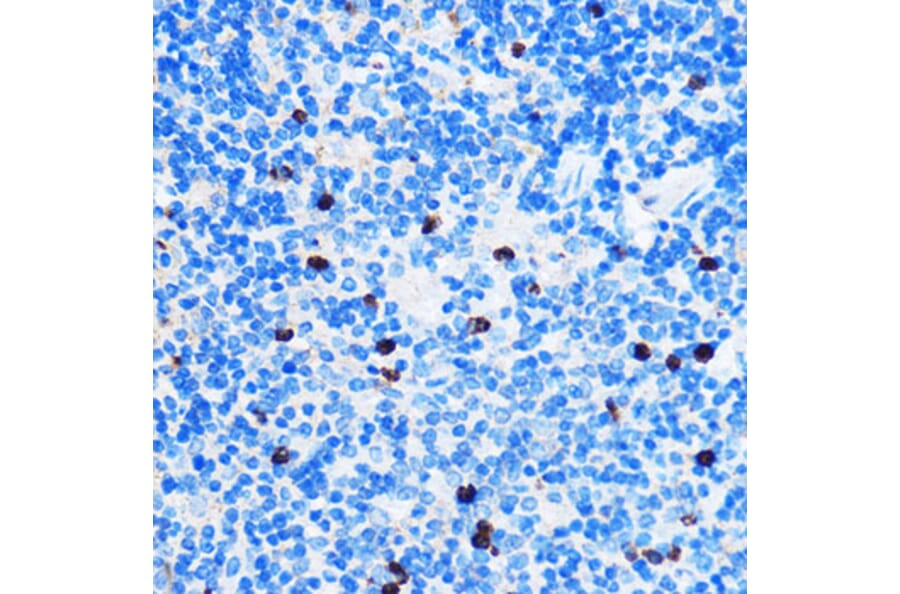 Immunohistochemistry - Anti-Chk1 Antibody (A10183) - Antibodies.com