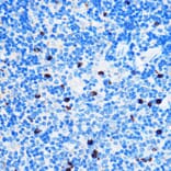 Immunohistochemistry - Anti-Chk1 Antibody (A10183) - Antibodies.com