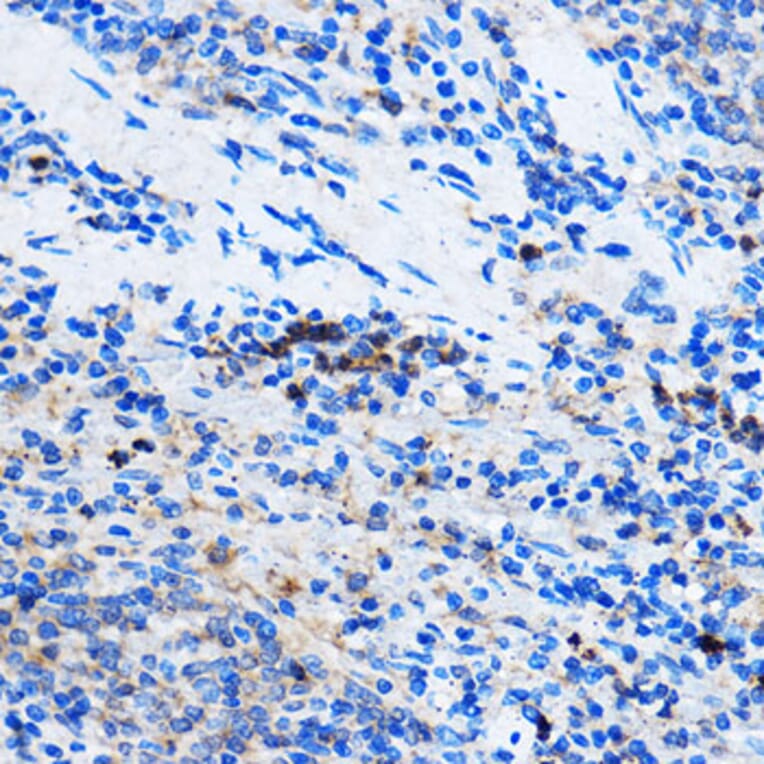 Immunohistochemistry - Anti-Chk1 Antibody (A10183) - Antibodies.com