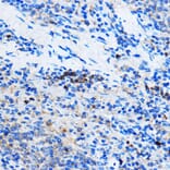 Immunohistochemistry - Anti-Chk1 Antibody (A10183) - Antibodies.com