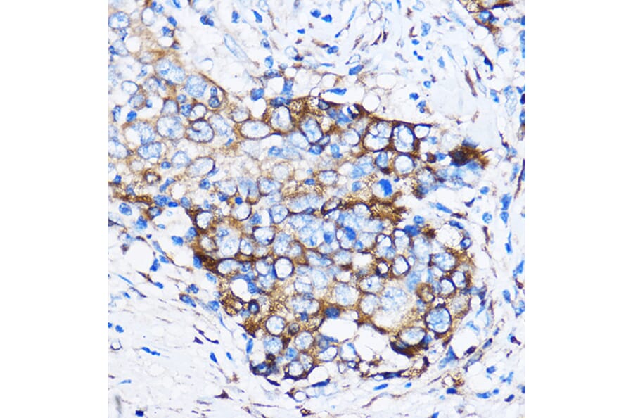 Immunohistochemistry - Anti-Chk1 Antibody (A10183) - Antibodies.com