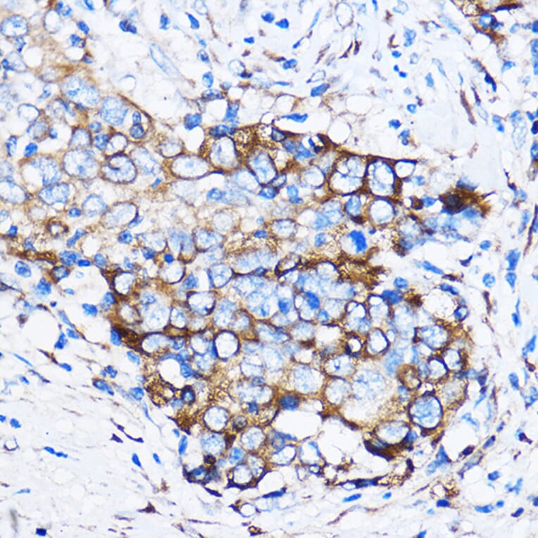Immunohistochemistry - Anti-Chk1 Antibody (A10183) - Antibodies.com