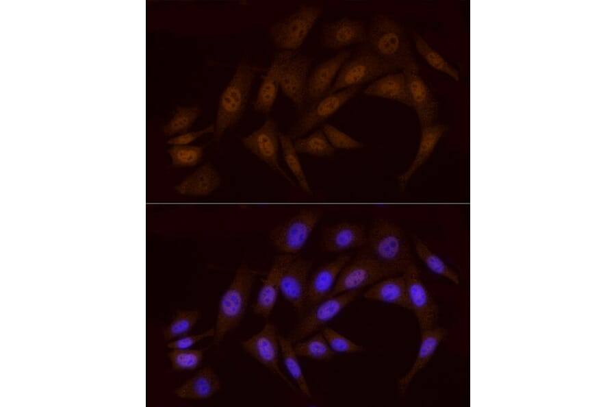 Immunofluorescence - Anti-Chk1 Antibody (A10183) - Antibodies.com