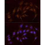 Immunofluorescence - Anti-Chk1 Antibody (A10183) - Antibodies.com