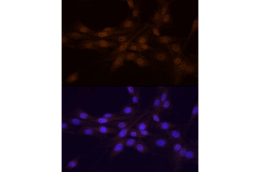 Immunofluorescence - Anti-Chk1 Antibody (A10183) - Antibodies.com