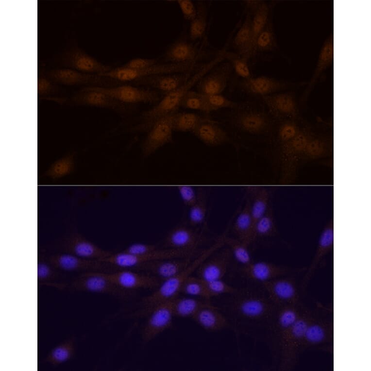 Immunofluorescence - Anti-Chk1 Antibody (A10183) - Antibodies.com