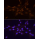 Immunofluorescence - Anti-Chk1 Antibody (A10183) - Antibodies.com