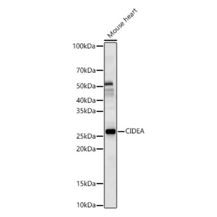 Western Blot - Anti-CIDEA Antibody (A10184) - Antibodies.com