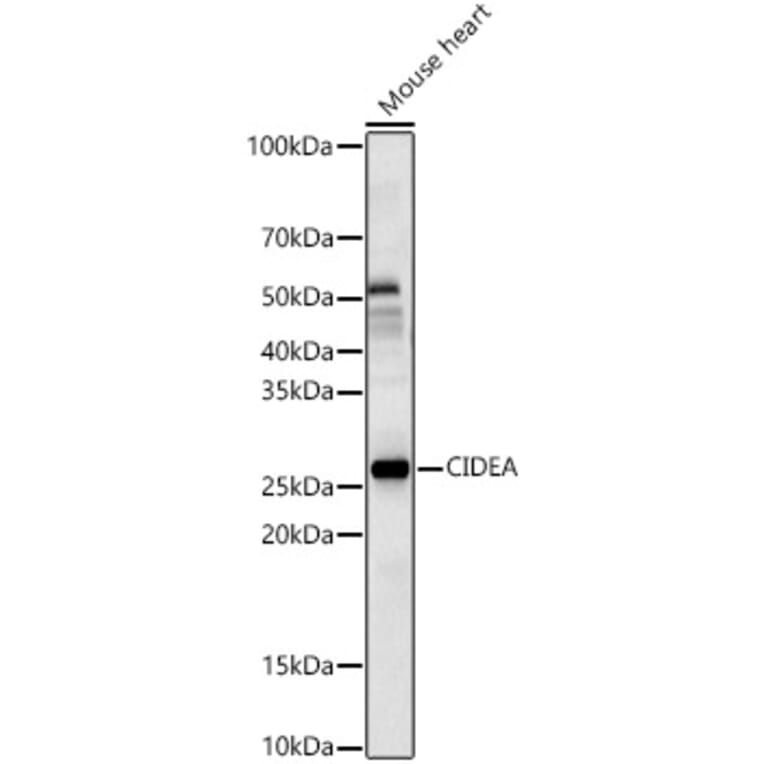 Western Blot - Anti-CIDEA Antibody (A10184) - Antibodies.com