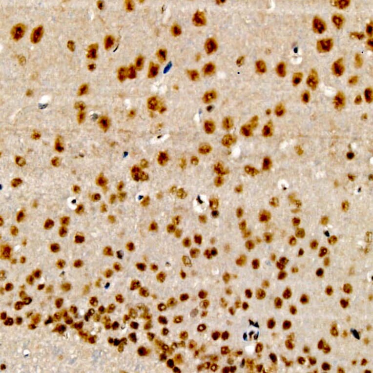 Immunohistochemistry - Anti-CIDEA Antibody (A10184) - Antibodies.com