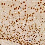 Immunohistochemistry - Anti-CIDEA Antibody (A10184) - Antibodies.com