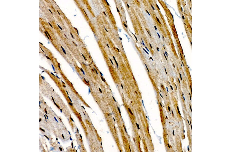Immunohistochemistry - Anti-CIDEA Antibody (A10184) - Antibodies.com