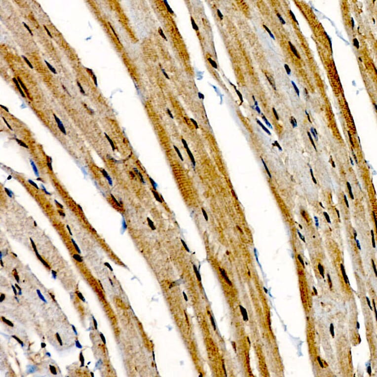 Immunohistochemistry - Anti-CIDEA Antibody (A10184) - Antibodies.com