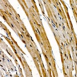 Immunohistochemistry - Anti-CIDEA Antibody (A10184) - Antibodies.com
