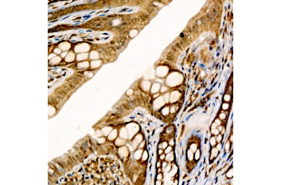 Immunohistochemistry - Anti-CIDEA Antibody (A10184) - Antibodies.com
