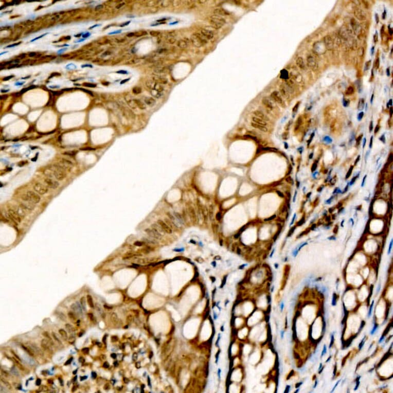 Immunohistochemistry - Anti-CIDEA Antibody (A10184) - Antibodies.com