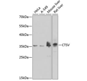 Western Blot - Anti-Cathepsin V Antibody (A10185) - Antibodies.com