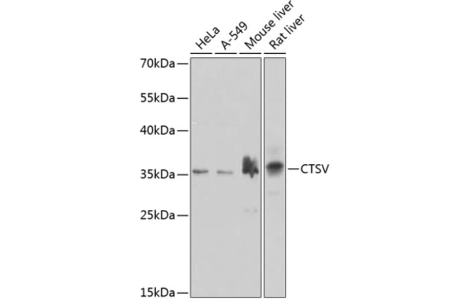 Western Blot - Anti-Cathepsin V Antibody (A10185) - Antibodies.com