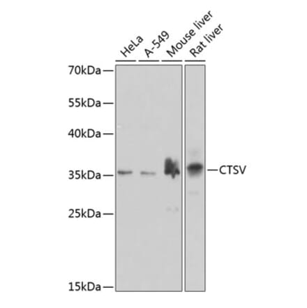 Western Blot - Anti-Cathepsin V Antibody (A10185) - Antibodies.com