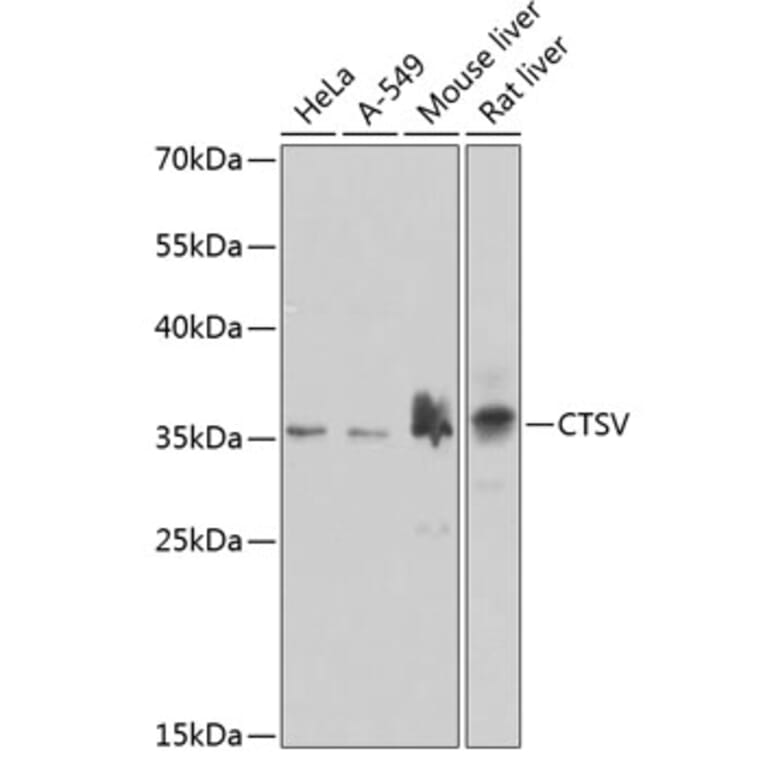 Western Blot - Anti-Cathepsin V Antibody (A10185) - Antibodies.com