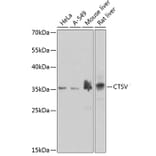 Western Blot - Anti-Cathepsin V Antibody (A10185) - Antibodies.com