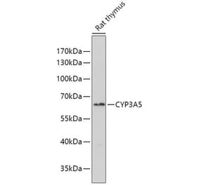 Western Blot - Anti-CYP3A5 Antibody (A10186) - Antibodies.com