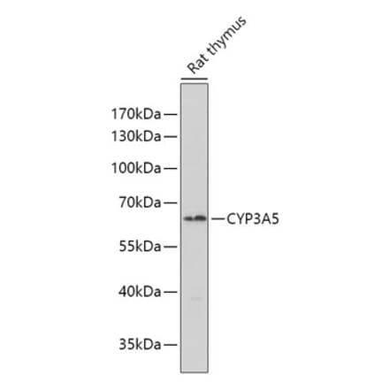 Western Blot - Anti-CYP3A5 Antibody (A10186) - Antibodies.com