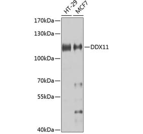 Western Blot - Anti-DDX11 Antibody (A10187) - Antibodies.com